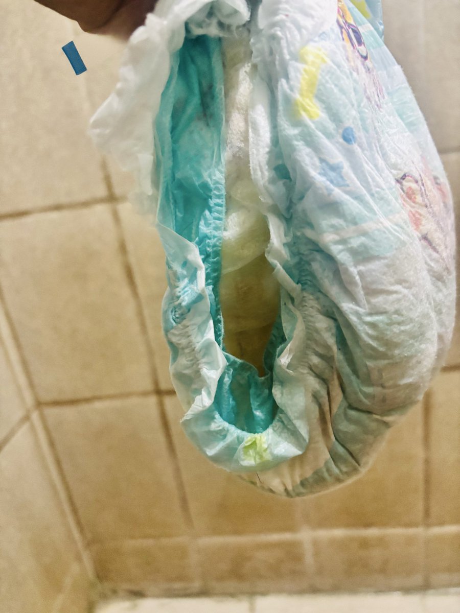 ice278017's tweet photo. Vamos às considerações..😕

Quem olha o Pacote imagina ter a melhor experiência do Mundo🤤 mais não é bem assim..

Pra qualquer Abdl magro ou cheinho, o elástico é péssimo rasga com muita facilidade, não dá pra negar absorve absurdamente bem, agora em relação ao preço caro💩 https://t.co/pWRMOYWjld
