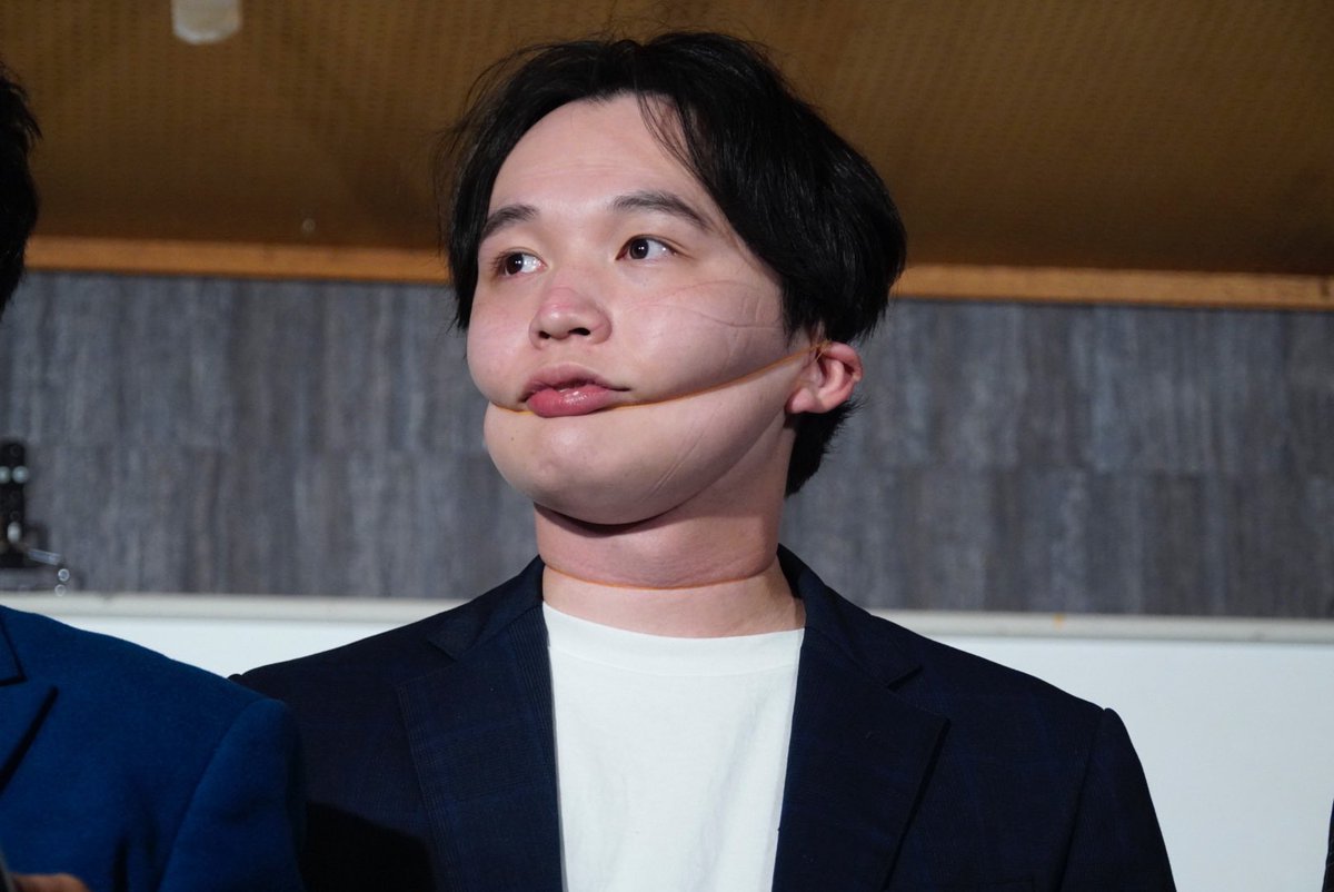 y4jef's tweet photo. 輪ゴム芸見た目が痛々しすぎて怖かったよーーー（ ｉ _ ｉ ）横さんは顔面メロンパンみたいになってたし、山田さんは武将になっていた🏆🌙 https://t.co/oZsB72rxXM