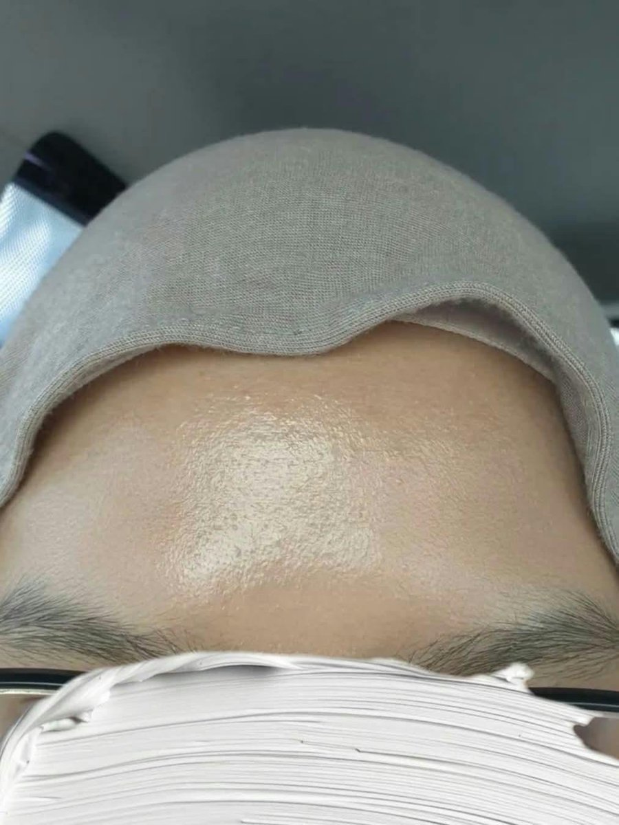 nazyeia's tweet photo. KORANG PERGI WATSONS SEKARANG CARI LaRoche Posay B5 😭 I just found tips if nak jerawat cepat kecut, nak muka smooth macam ontot baby pakai ni. Dia cakap pakai sekali tidur, bangun jerawat kecut &amp; redness hilang, I ingat overclaim. BUT i sendiri dah guna legit jadi weh! https://t.co/xQfsGng2mj