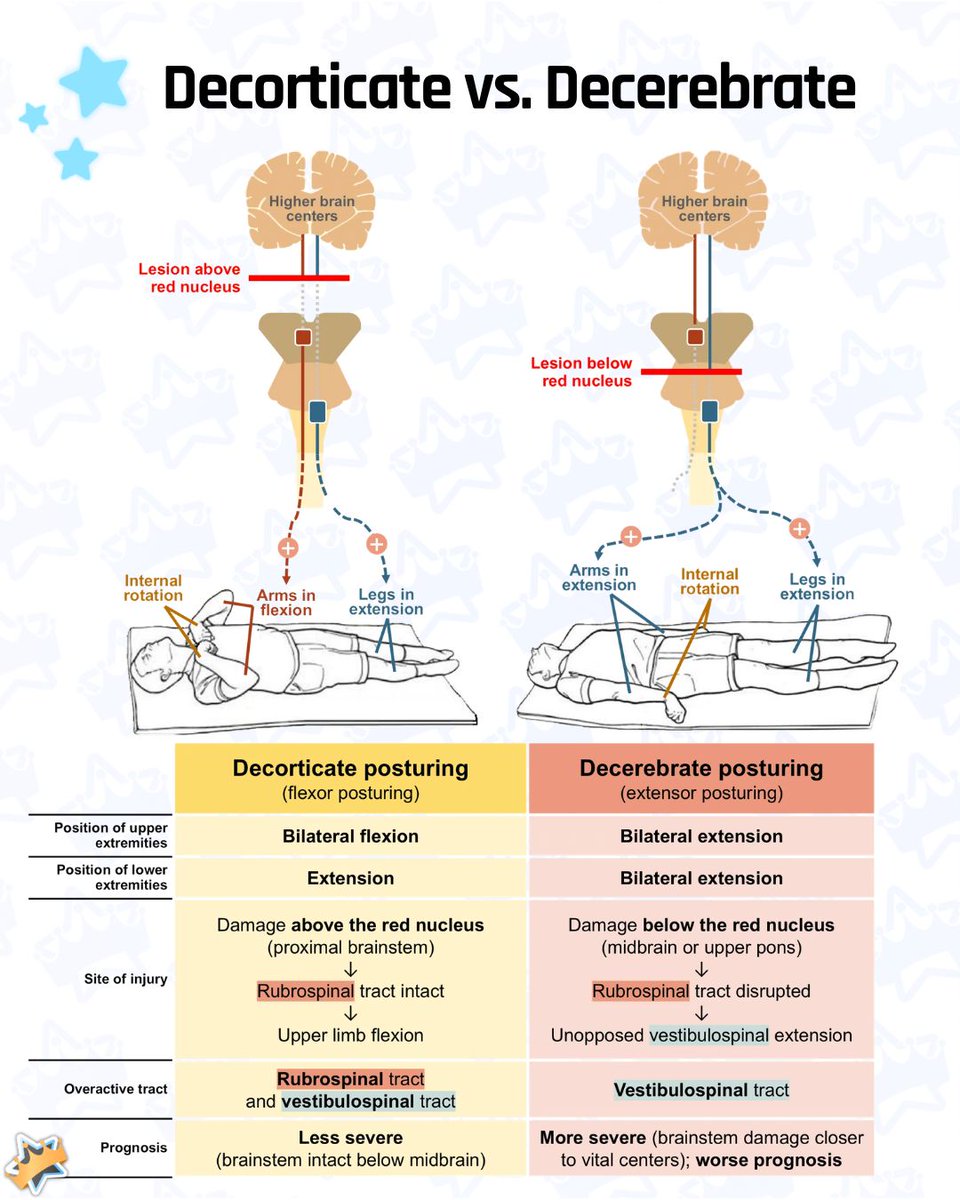 AnKingMed's tweet photo. 🧠 Decorticate and decerebrate posturing are critical clinical indicators of acute brainstem injury.

⭐ Want to study less and remember more? Create an account on AnkiHub via the link in our bio! https://t.co/09DgzV8eXF