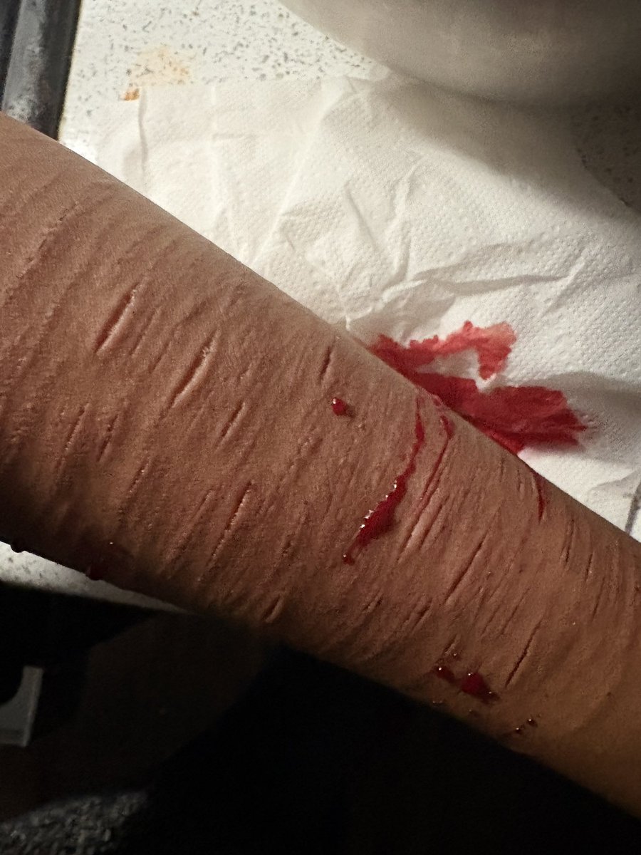 kinkguts's tweet photo. FAKE SFX MAKEUP from yesterday cus I have to go somewhere tn #slittwt #shtwt #988twt https://t.co/YA6AZ6B5ME