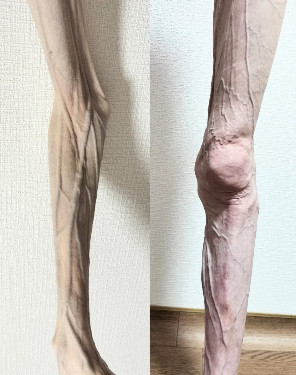 Renaissance1827's tweet photo. How do people mistake my arm (left) for my leg (right)? 😅 https://t.co/uzKdJJBGvL