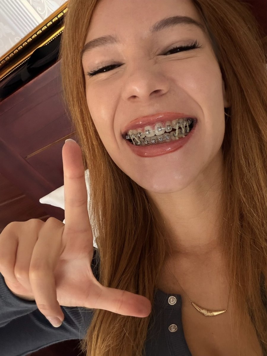 bbmorgz's tweet photo. don’t even try to hide it, brats with braces get you leaking like nothing else… https://t.co/XvVaubQ2RK