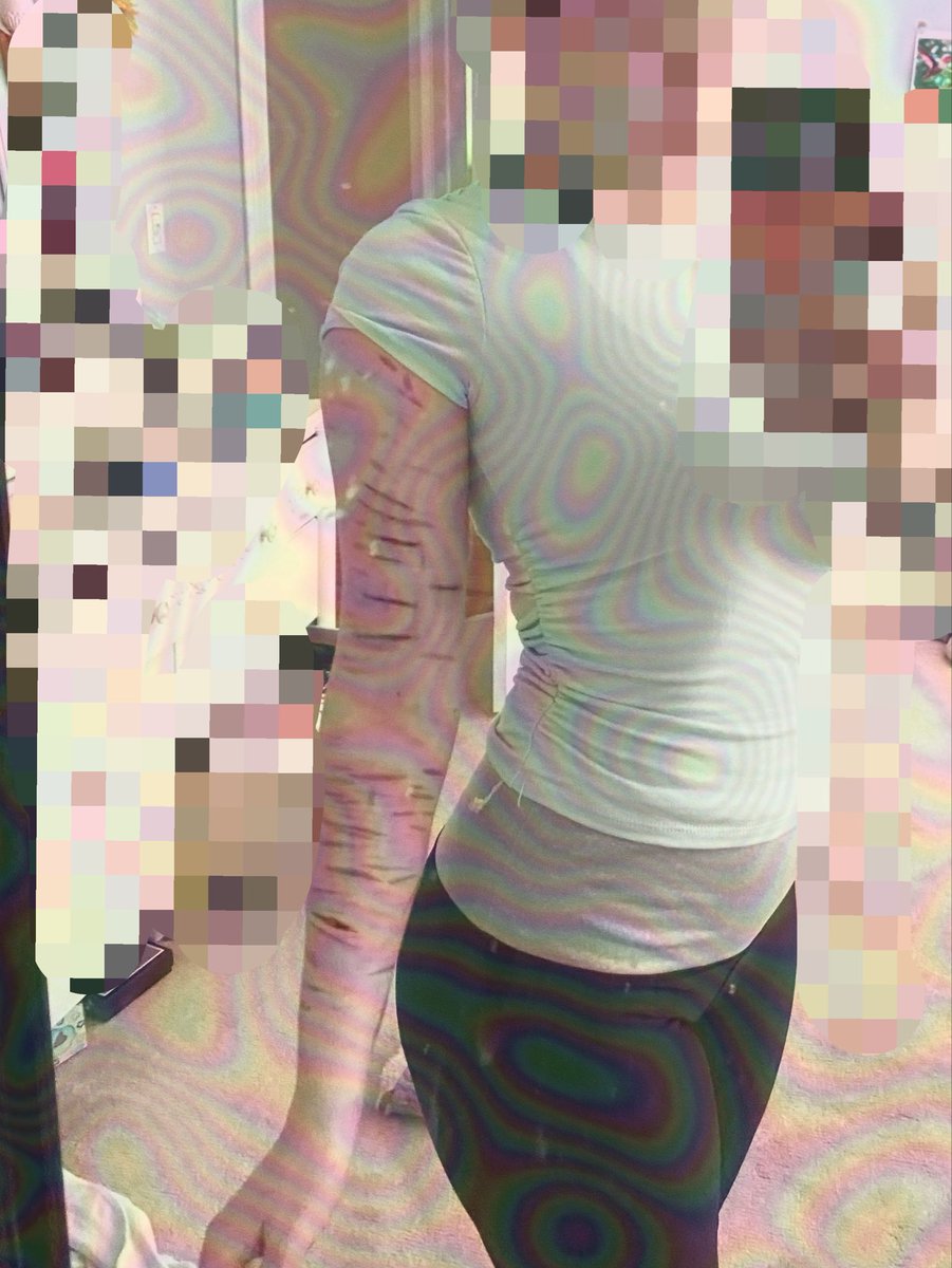 oliveeeax's tweet photo. sc4rs before getting worse 
—

FAKE AI GENERATED SFX MAKEUP 
#slittwt #ouchietwt #988twt #shrtwt https://t.co/uGlO0izwRX