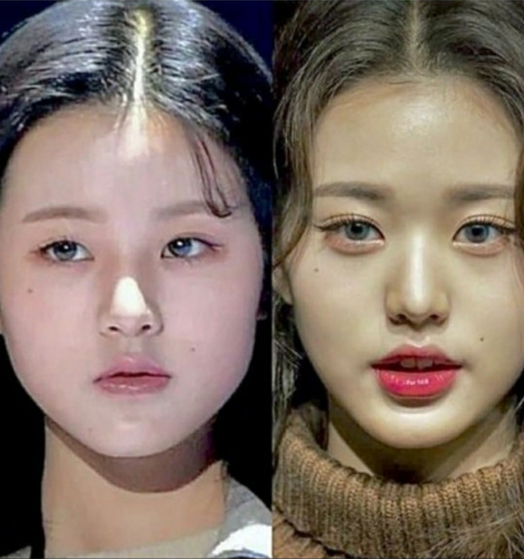 ss6dyg's tweet photo. @fufufuckck plastic surgery monster korean woman https://t.co/jcI6vf9vFa