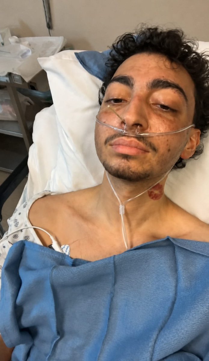 Savelivescancer's tweet photo. 🧠 My brain cancer surgery is only days away. I’m scared, but I’m holding onto hope and choosing to keep fighting. Your prayers, kindness, and support mean more than I can put into words.
https://t.co/Aq6IzOGrWu https://t.co/xu6Q9FZvji