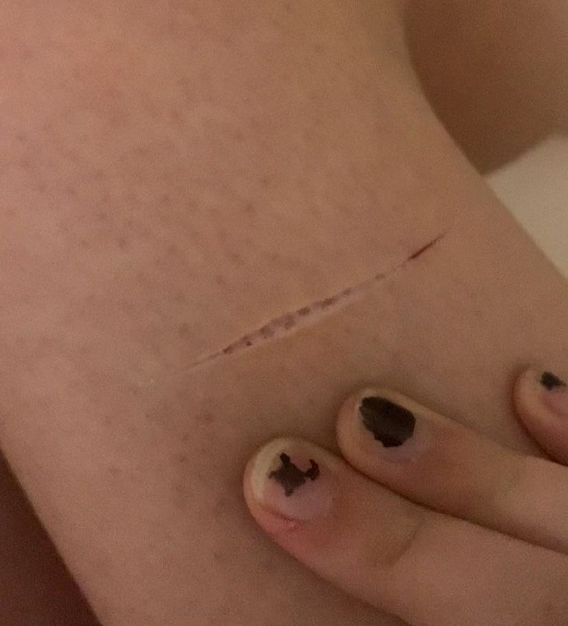 C4M1468's tweet photo. guys guys guys what do we think the scar is gonna look like??  🤔 #slitttwt #988twt #shtwt #ouchietwt 

FAKE SFX MAKEUP IM A PRO MAKEUP ARTIST IT’S ALL FAKEE https://t.co/ftSAoEJOWf