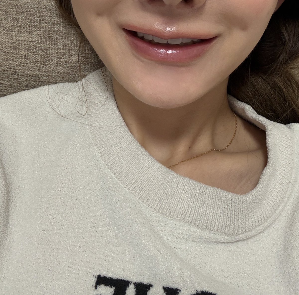 8929_tabe's tweet photo. 脂肪注入したところがエクボになった人いますか？🥺
注入した傷だと思ってたらちゃんと凹んでたんだけど

鼻下が動かないからたまたま変なところに力入ってるだけかな？
(にしてはドンピシャだけど) https://t.co/P3h0tAJ48p
