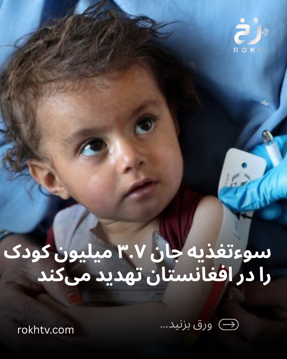 rokhtv's tweet photo. صندوق حمایت از کودکان سازمان ملل متحد (یونیسف) هشدار داده است که ۳.۷ میلیون کودک زیر پنج سال در افغانستان در معرض سوءتغذیه حاد قرار دارند و حدود یک میلیون نفر از آنان با شدیدترین و مرگبارترین نوع این بیماری روبه‌رو هستند. ￼ https://t.co/PByWgRHwyV