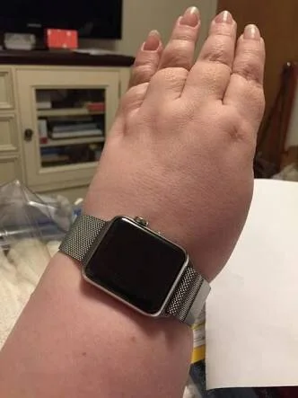 Dianexis's tweet photo. I love scrolling through the media from people who consistently hate reply to me (natsoc accounts etc) until I eventually see them posting something about watches (they love posting watches) and it's always a hand that looks like this https://t.co/ysVBW0I85b