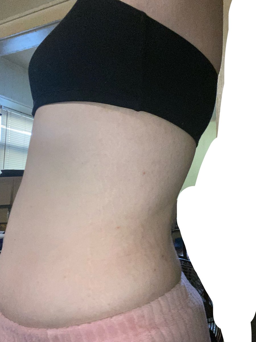 tag_bones's tweet photo. Before and after losing 50 pounds, I’m finally seeing a different :) https://t.co/1rsCvlQBKZ