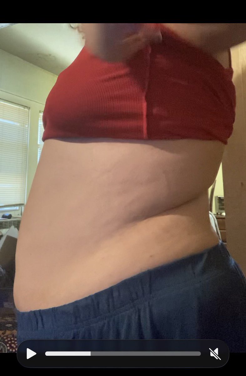 tag_bones's tweet photo. Before and after losing 50 pounds, I’m finally seeing a different :) https://t.co/1rsCvlQBKZ