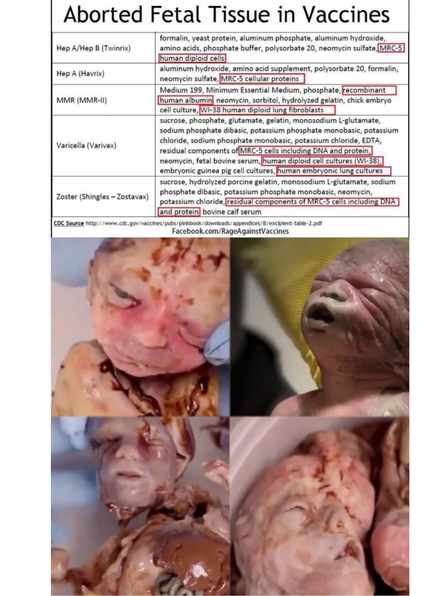 liz_churchill10's tweet photo. You really need to ask yourself why the Vaccine Cartel wants to force you to inject your children with dead children… https://t.co/cqCLiQlOqG