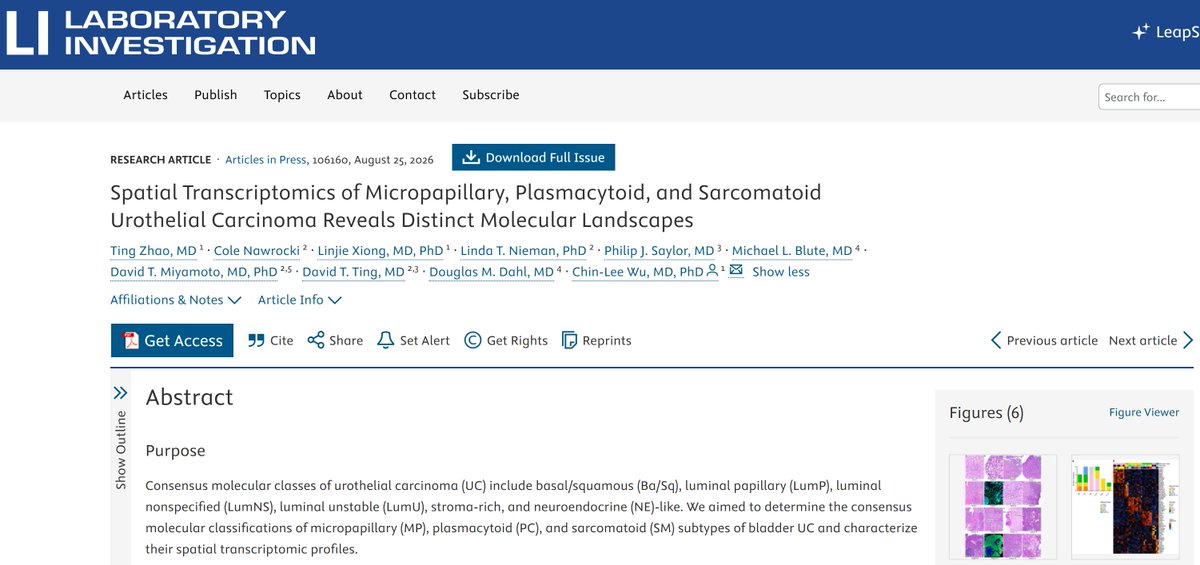 TingZhaoPathdoc's tweet photo. 🚨Excited to share that our second spatial transcriptomics paper on GU tumors has been published! @LIjournal @TheUSCAP @MGBpathology 
💠Spatial Transcriptomics of Micropapillary, Plasmacytoid, and Sarcomatoid Urothelial Carcinoma Reveals Distinct Molecular Landscapes
➡️Read here: https://t.co/16R0hruyG6

💡Our prior spatial transcriptomics study on prostate cancer:
https://t.co/B1RfO6gyNf

@IntSocUropath @GU_Path_Society 
#Molpath #GUpath