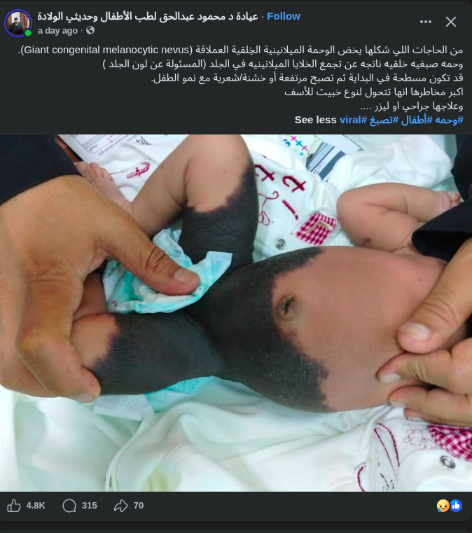 Hello_Ninja_'s tweet photo. مش المفروض الحجات دي بتكتشف قبل الولاده ؟ ربنا يصبرهم https://t.co/lHrS2BnEY6