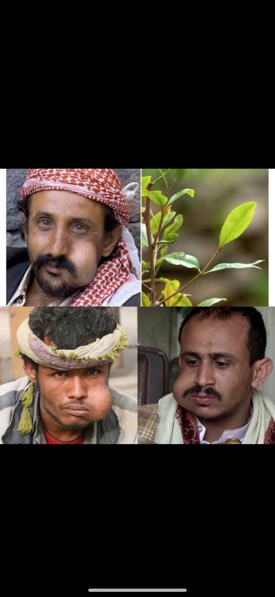 nnzzzz111's tweet photo. @yl2vv اليمني هندوحبشي يعلف قات وشعر مجعد جدا https://t.co/y3x0h7Yuau