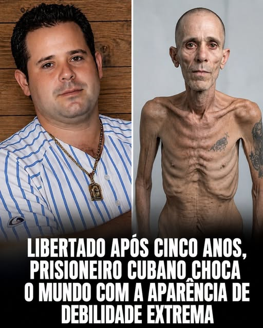 EduArdo52088723's tweet photo. Alexander Díaz Rodríguez deixou uma prisão cubana depois de anos de confinamento, mas o que chocou o mundo foi a condição em que ele saiu.
Após passar cerca de cinco anos encarcerado por sua participação nos protestos de 11 de julho de 2021, Díaz Rodríguez foi libertado + https://t.co/gEFts2WPpi