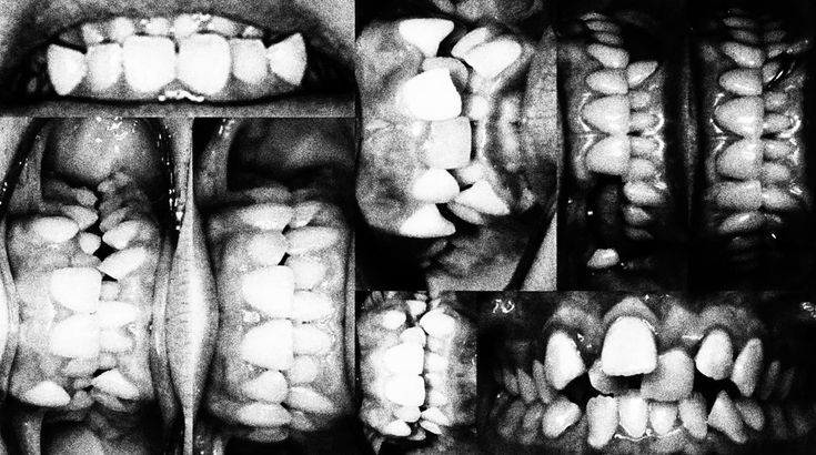 medicalabuse's tweet photo. 🩹༌། ྀ₊ https://t.co/dT38KqMsBo