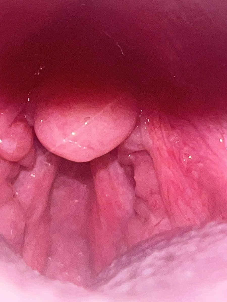 gothicperv's tweet photo. My mouth is gross because I’m a neet 

Too bad I don’t really care what a speck has to think and I’m sticking you there anyway https://t.co/KdUz4dP4yF