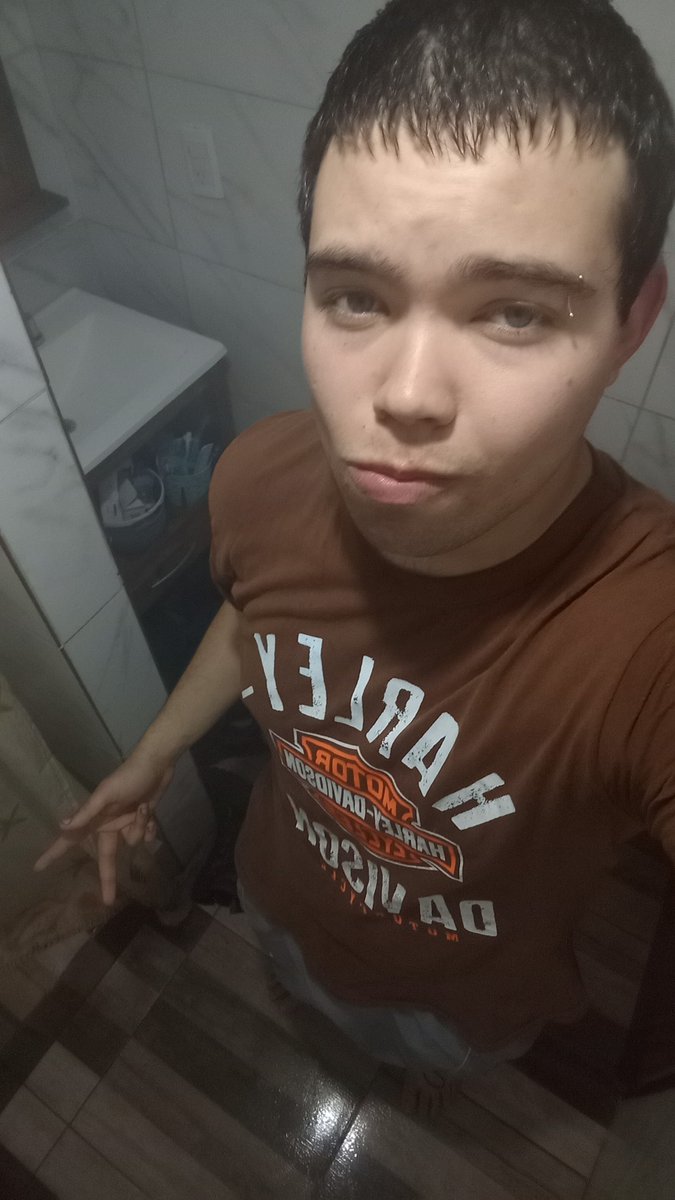 437candia's tweet photo. @roerbaak No se yo tengo alopecia https://t.co/Zz0uIDdExo