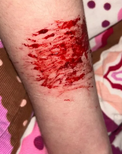 baozizaii's tweet photo. DE NUEVO oki FAKE NOT REAL TWITTER es maquillaje para efectos especiales, m encanta la sangre https://t.co/H9e2xGTxKr