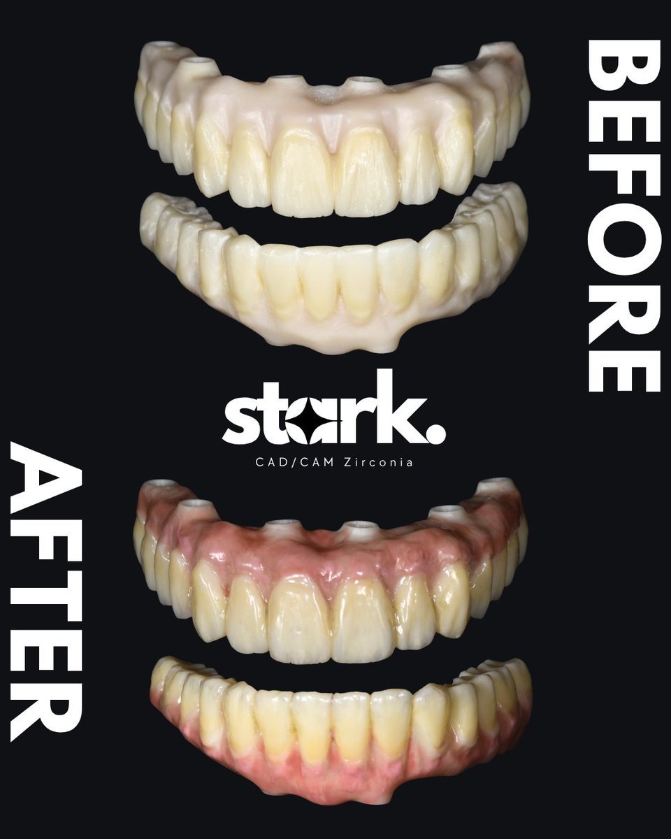CARES_Solution's tweet photo. 弊社で販売している【Stark Zirconia Disc】で
製作!✨
#Stark #歯科技工士 #歯医者 #技工 #歯科技工所
#歯科医院 #ジルコニア #ジルコニアセラミック
#セラミック #セラミックス #インプラント
#CARESソリューションセンター #dental
#dentaltechnician #dentalmorphology #dentalwork
#implant https://t.co/3X8EfS82Tg