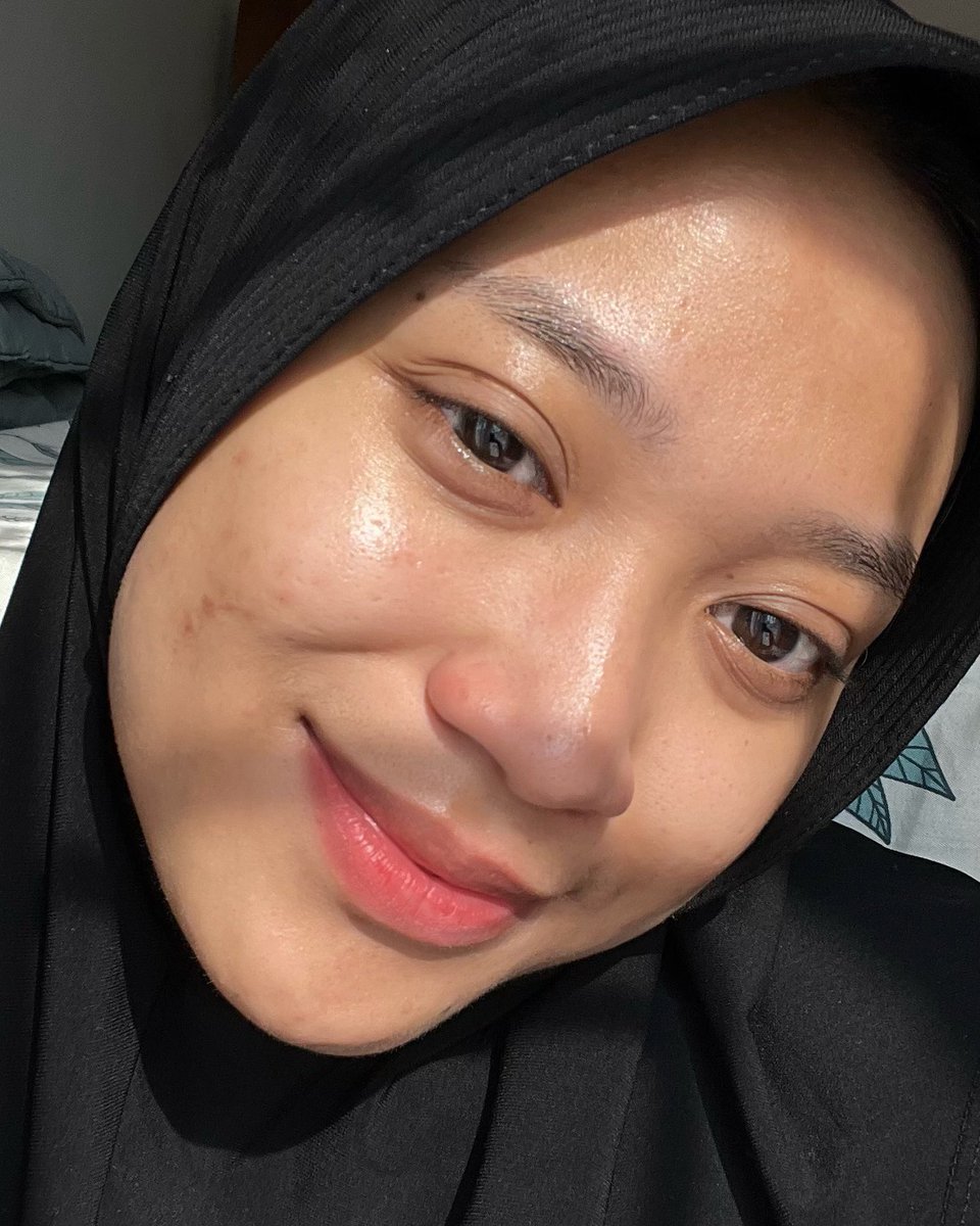 twisssco's tweet photo. ALHAMDULILLAH in this economy masih bisa dapetin kulit cerah plus glowing cuma pake skincare set yg total harganya cuma 100ribuan aja 🩷✨ https://t.co/Xl2LEXdk0W