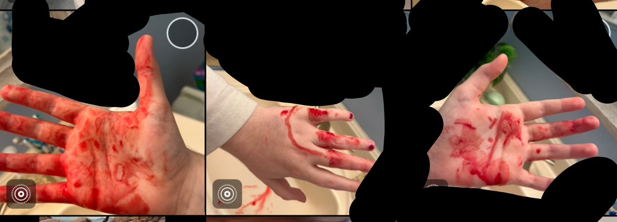 VoiidsDecay's tweet photo. flashback to when i stabbed myself https://t.co/P0WtOqZOmn