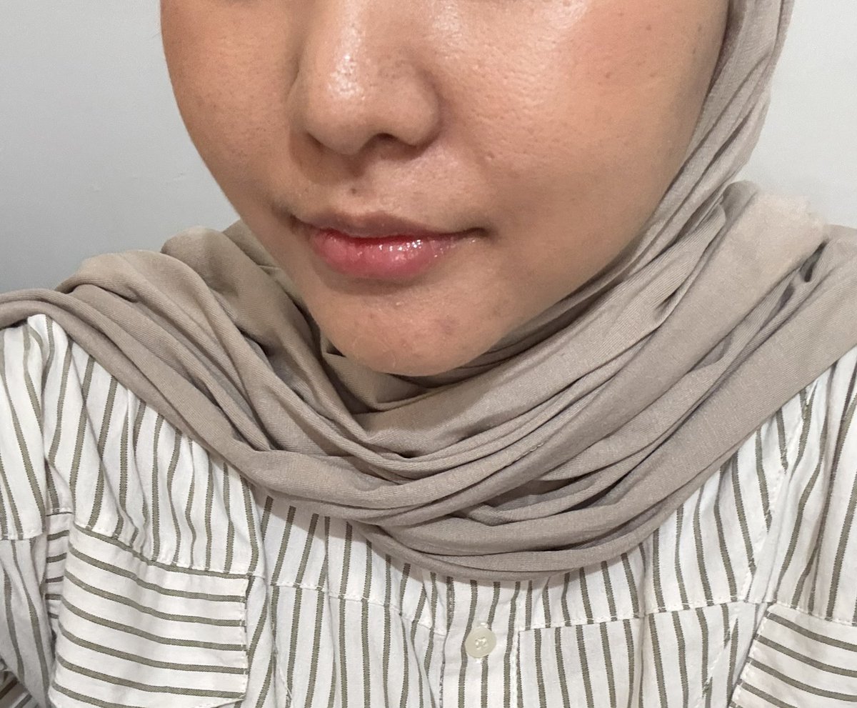 Masitamii's tweet photo. ACNE PATCH YANG TRANSPARAN, TAPI KERJANYA NGGAK MAIN-MAIN 😭✨

YOROBUNNN!!! Aku happy banget nemu acne patch yang transparan dan nempel banget 😭 Jadi dipakai siang-siang juga nggak terlalu keliatan. Plus, dia punya kandungan Acne Shooting Effect ✨ https://t.co/F2BzuDcCtH