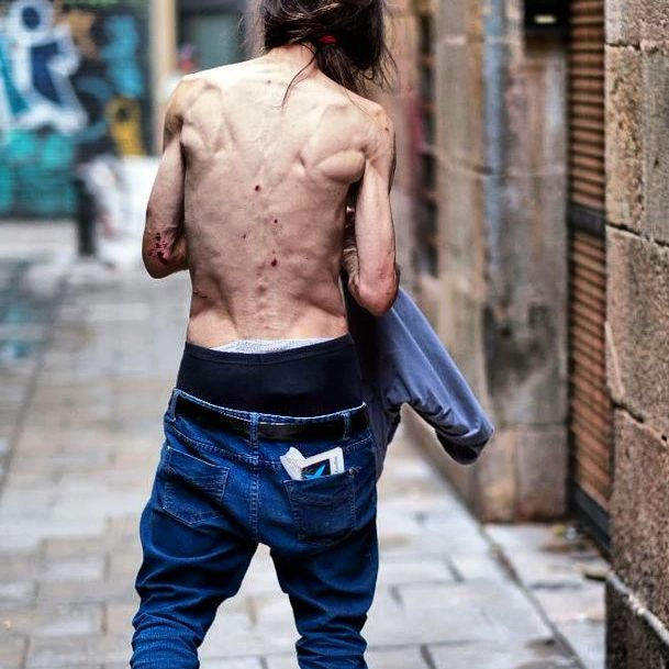outsidersesp's tweet photo. Heroína y fuerzas del orden público.

«(…)  No puedo olvidar como venían «Los maderos» descargando ellos mismos los  fardos, acompañados de varios tíos de paisano, sacos llenos de polvo  blanco en el almacén de Piletas que era de un picoleto. Desde allí  comenzaba la distribución, a la casa llegaban los coches de los camellos  y cargaban los portabultos de droga, desde allí se repartía pa toda la  zona de Tamaraceite, Guanarteme, Schamann, El Buque Guerra, una parte de  El Polvorín, Escaleritas, Las Rehoyas, etc. Todos sabíamos que «El  caballo» lo metía el régimen, que aunque Franco hubiera muerto dos años  antes, todo seguía igual compadre, igual que sigue ahora en el 2008, que  tenían que parar como fuera a esa juventud luchadora, la misma que  había heredado la conciencia política de quienes luchamos contra la  dictadura. En menos de tres meses comenzamos a ver muertos vivientes por  las calles, montón de muchachos decentes, que no pasaban de echarse un  pizco ron o de fumarse un canuto de marihuana o hachís, a verlos  tirados, robando a la gente del barrio, sin camisa, buscando follones  con los vecinos. Fue terrible el efecto de esa droga, fue mortal como  esta mierda de democracia siguiera los dictados de la CIA, lo mismo que  hicieron en Latinoamérica, igual que hicieron en Euskadi, Galicia,  Cataluña, Andalucía, Extremadura, los barrios de Madrid, en todo lugar  donde temieran que la gente joven tomara el timón de la lucha para  expulsar del poder a esos Reyes impuestos por un dictador fascista, a  tantos políticos falangistas y sus herederos de aquellos años, los mismo  de ahora te insisto, porque los que llevan el poder en España son todos  herederos del franquismo más criminal.

A los seis  meses de ver como descargaban esos perros la droga mis hijos se  engancharon, lo noté una noche que llegué de trabajar del muelle y me  olió raro, fui a la habitación de Mari Carmen y allí estaban los dos  fumando «jaco». Casi los mato, pero pasaron de mi, Toni murió de  sobredosis, apareció muerto en una ladera del Castillo de Mata, junto a  las cuevas de San Antonio, María desapareció para siempre, no se donde  coño pudo haber acabado, solo supe que ejercía la prostitución en El  Lugo, la busqué, pero fue imposible, no la vi más. Así tantos jóvenes,  tanta gente buena echada a perder por esos sicarios. Tantos años de  lucha camarada, como nos la jugamos para intentar traer a España la  verdadera libertad, para haber acabado de esta forma. Sigo pensando que  el fascismo sigue vivo, que ahora tiene otros recursos, que por ahora no  pega de nuevo tiros en la nuca, lo tiene mejor con las drogas y el paro…»

Fragmento de la entrevista al ex miembro de la CNT, Manuel  Santana Cabrera («Manu»), el 7 de julio de 2008 en Los Giles, LPGC,  realizada por Francisco González Tejera, integrada en sus trabajos de  investigación sobre el genocidio fascista en las Islas Canarias.