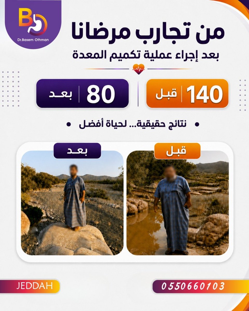 BothmanDr's tweet photo. من تجارب مرضانا
لمعرفة المزيد تواصل مع عيادة الدكتور #باسم_عثمان 
إستشاري جراحة السمنة
الزمالة الفرنسية في جراحة السمنة🇫🇷
البورد الأوربي في جراحة المناظير
للتواصل👈🏼 0550660103📲
📍جدة
#تكميم_المعدة
#جدة
#مساء_الخير
#صباح_الخير
https://t.co/dkz9TwekTR https://t.co/x0QBCknteX