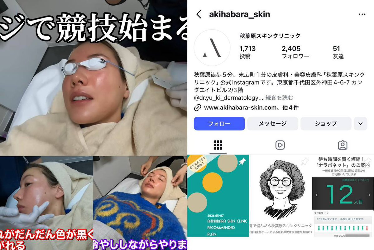 harapeko_cn's tweet photo. 芸能人肌治療クリニックまとめ🏥✨

IVEウォニョン
📍AMRED CLINIC エムレッド医院
韓国ソウル チョンダム駅

田中みな実
📍青山ヒフ科クリニック
東京都港区北青山 表参道駅

指原莉乃
📍R.O. clinic
東京都渋谷区神宮前 表参道駅

仲里依紗
📍秋葉原スキンクリニック
東京都千代田区外神田 秋葉原駅 https://t.co/eBqXVLHwxE