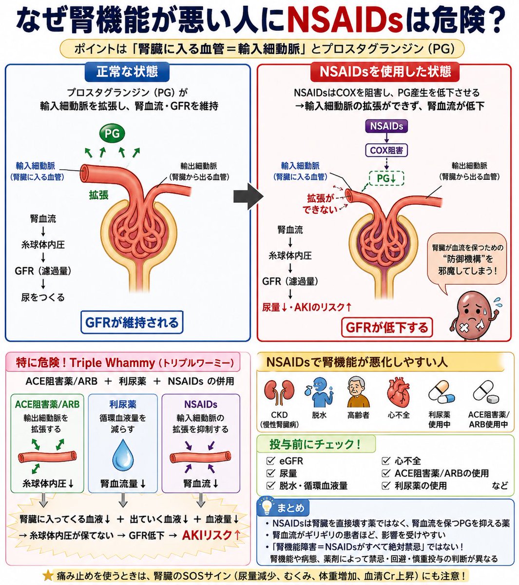 iroiroYI's tweet photo. 【なぜ腎機能が悪い人にNSAIDsは危険？💊】

「腎臓が悪いからロキソニンはダメ」
これ、理由まで説明できますか？

ポイントは
**「腎臓に入る血管＝輸入細動脈」**です。

まず正常な腎臓では👇

血液
↓
輸入細動脈
↓
糸球体で濾過
↓
尿をつくる

腎臓は十分な血流がないと、GFR（糸球体濾過量）を維持できません。

では脱水・心不全・CKDなどで腎血流が低下したら？

ここで活躍するのが
🔥プロスタグランジン（PG）

PGは輸入細動脈を拡張させ、

「腎臓に入る血液を確保しよう！」

と腎血流・GFRを維持する方向に働きます。

ところがNSAIDsは👇

NSAIDs
↓
COX（シクロオキシゲナーゼ）阻害
↓
プロスタグランジン産生↓
↓
輸入細動脈を拡張する力↓
↓
腎血流↓
↓
糸球体内圧↓
↓
GFR↓
↓
⚠️AKI（急性腎障害）につながる

つまりNSAIDsは、

❌「直接腎臓を壊す薬だからダメ」

というより、

⭕️腎臓が血流を維持するために使っている“防御機構”を邪魔してしまう

と理解すると分かりやすいです。

特に注意したいのが👇

・CKD
・脱水
・高齢者
・心不全
・利尿薬使用中
・ACE阻害薬/ARB使用中

有名なのが
💥Triple Whammy

ACE阻害薬/ARB
＋利尿薬
＋NSAIDs

利尿薬
→循環血液量↓

ACE阻害薬/ARB
→輸出細動脈が拡張

NSAIDs
→輸入細動脈の拡張を抑制

つまり、

「腎臓に入ってくる血液↓」
＋
「腎臓から出る側が拡張」
＋
「そもそもの血液量↓」

→糸球体内圧が保てない
→GFR低下
→AKIリスク↑

💡覚え方

NSAIDs
＝腎臓の“入口を広げるPG”を抑える薬

だから腎血流がギリギリの患者ほど影響を受けやすい。

NSAIDs投与前は
「Crだけ見る」のではなく、

✔️eGFR
✔️尿量
✔️脱水・循環血液量
✔️心不全
✔️ACE阻害薬/ARB
✔️利尿薬

まで確認するのが大切です。

※「腎機能障害＝NSAIDsがすべて絶対禁忌」ではなく、腎機能や病態、薬剤によって禁忌・回避・慎重投与の判断が異なります。

#看護師 #看護学生 #新人看護師 #看護師勉強垢 #看護師国家試験 #薬理学 #NSAIDs #ロキソニン #腎機能 #腎不全 #AKI #CKD #病態生理 #医療知識 #看護
