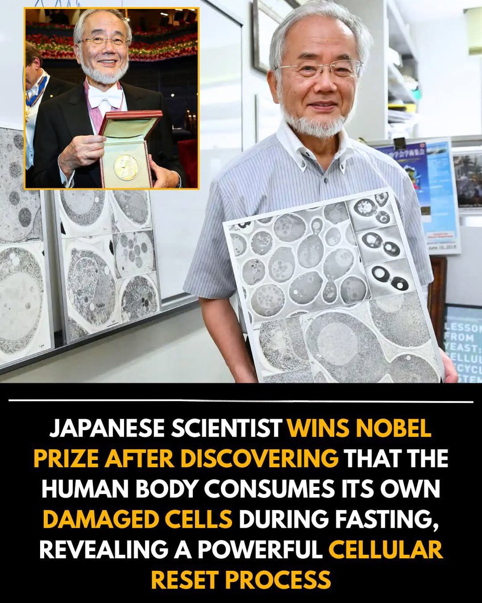 ShiningScience's tweet photo. 🚨 A Japanese scientist earned a Nobel Prize after discovering one of the body’s most powerful self-healing mechanisms: during periods of fasting, the human body begins to consume its own damaged cells, triggering a deep cellular reset known as autophagy. This natural process acts like an internal cleanup system, breaking down old proteins, malfunctioning components, and toxic buildup that contribute to aging and disease. The discovery revealed that fasting doesn’t just change metabolism — it activates a fundamental survival program hard-wired into our biology.

Researchers found that autophagy boosts cellular renewal, supports immune function, protects against neurodegeneration, and improves overall resilience. When the body isn’t busy digesting food, it shifts focus to maintenance and repair, recycling damaged parts into fresh, healthy components. This helps reduce inflammation, sharpen brain function, and improve the body’s ability to handle stress. Some studies even show that activating autophagy may lower the risk of chronic conditions linked to aging.

The Nobel-winning research transformed how scientists view fasting, turning it from a simple diet trend into a legitimate biological reset. Doctors now say intermittent fasting — when done safely — can help support long-term cellular health, boost energy, and improve metabolic balance. While it’s not a cure-all, the discovery showed that the body has extraordinary built-in abilities to heal itself when given the right conditions.

For millions around the world, the research opened a new window into how deeply our lifestyle affects our cells — and how something as simple as timing our meals can unlock one of the body’s most powerful repair systems.