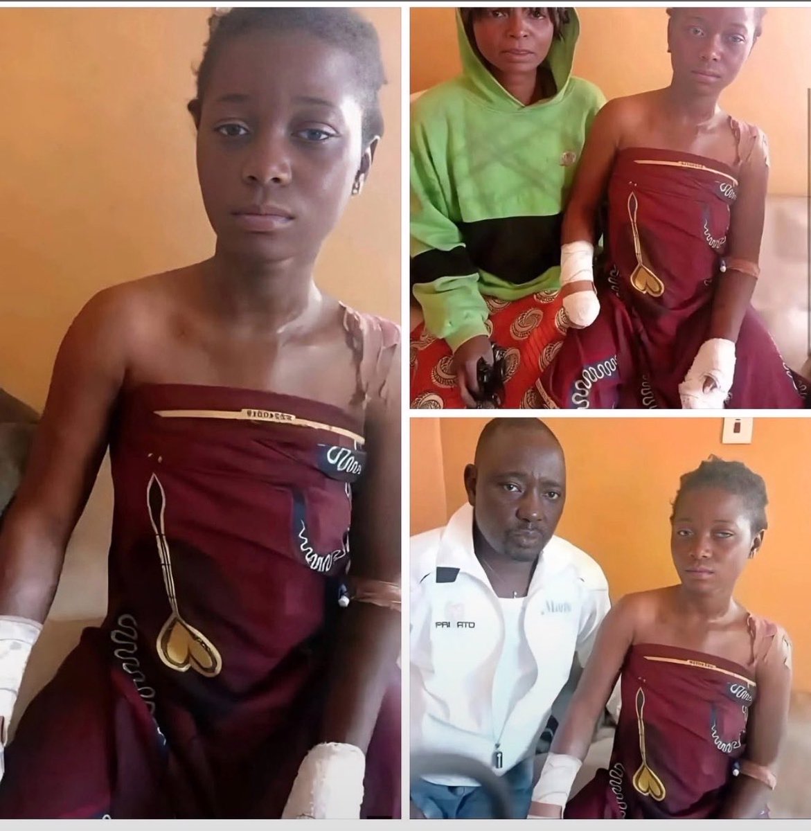 sappholives83's tweet photo. Endurance Sabon is only 15, and a Christian, so when a Muslim man demanded her hand in marriage, her parents refused. To retaliate, he and eight accomplices attacked Endurance, and mutilated her by cutting off both of her hands with a machete. 

Violence against Christian girls in Nigeria is shockingly common. Many are kidnapped and forcibly converted to Islam before being married off to older men. Others, like Endurance, have been attacked and mutilated, most commonly with acid. One girl, 18 year old Binish Paul, was thrown from a second story roof by a Muslim man named Tabeer Abbas after she refused to convert to Islam and marry him, suffering catastrophic injuries to her spine and legs. Local law enforcement often protects the perpetrators of these crimes, and persecutes surviving victims. 

Everywhere Islam goes, female suffering follows.