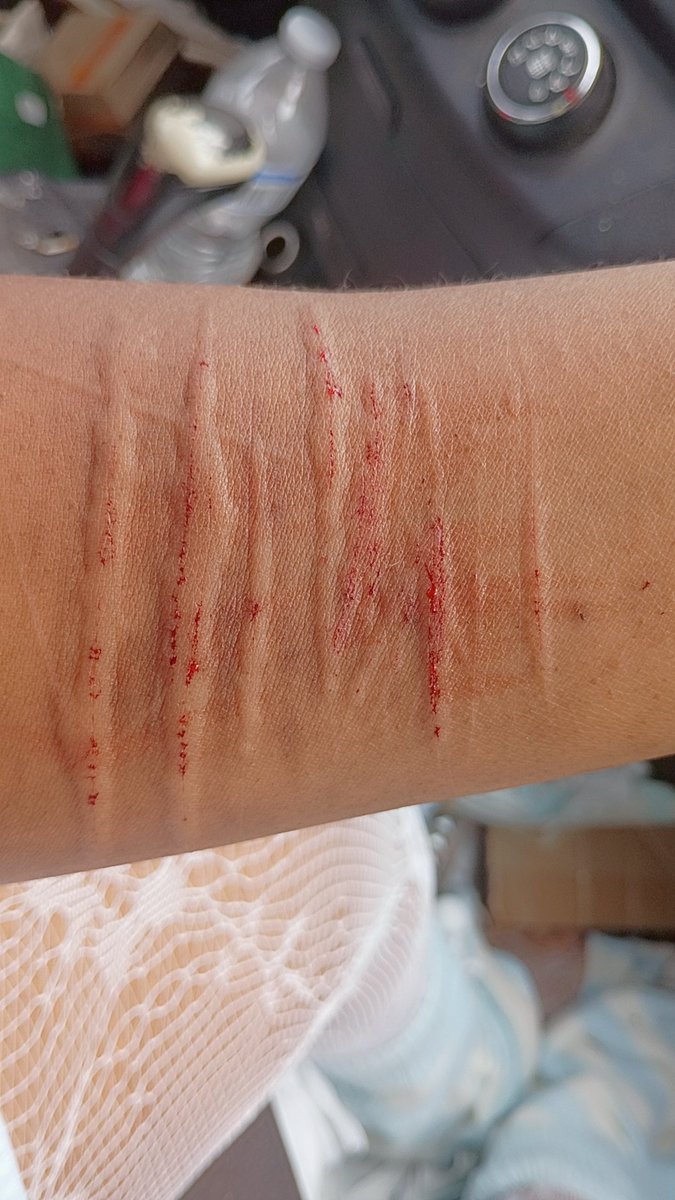 0__0grl's tweet photo. i  want  to  kms  so  so  so  bad  haha https://t.co/QIHjd7lKTd