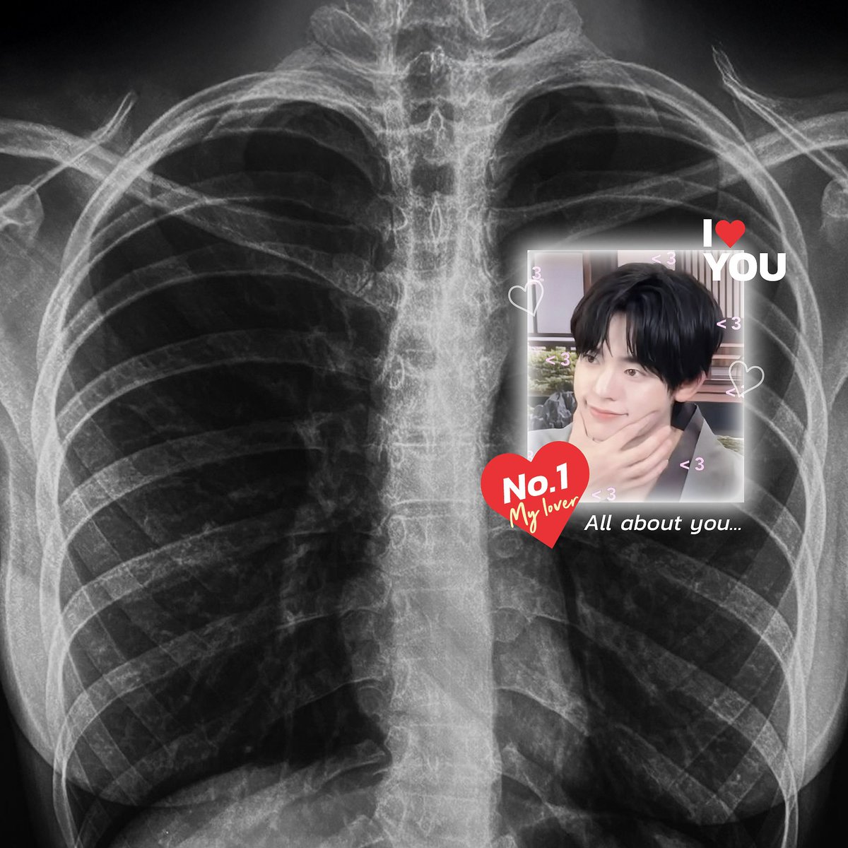 ilyfaann's tweet photo. ตื่นมาเช้านี้นี่ร่างกายผมเป็นอะไยค้าบเนี่ย หัวใจเต้นดังปิ๊ปปิ๊ป หรือว่าในใจผมมีแต่ปิ๊ปไปหมดแล้ว 🩺💗🐻‍❄️ https://t.co/LjvE0ClXfO