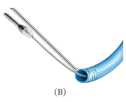 gbiondizoccai's tweet photo. Must-read tutorial on rotational atherectomy through guide extension catheters, courtesy of the Journal of Inverventional Cardiology https://t.co/gu6HuiAjc9 https://t.co/v1dHeBUARk
