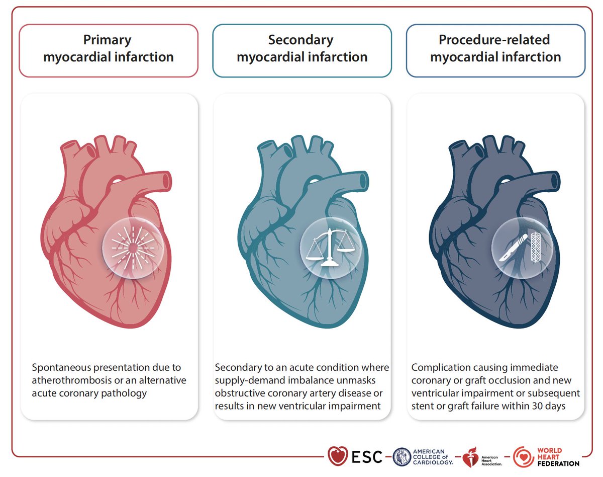gonzaeperez's tweet photo. ❌ SE ACABAN LOS "TIPOS" DE INFARTO 
🔴Adiós a la clasificación numérica (1, 2, 3, 4a-c, 5) que usamos desde hace más de 20 años. 

🆕Ahora hay 3 escenarios clínicos👇
#ESCCongress https://t.co/QRfp1SaMQq