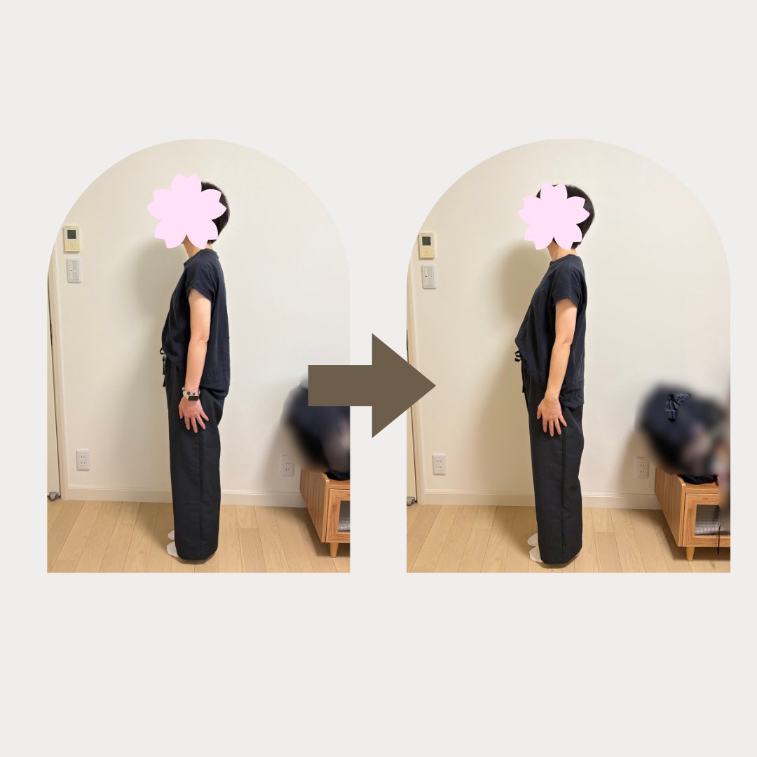 sachan0114's tweet photo. 不調の原因を探してみると…
肩こりや頭痛の原因は
肩や首だけ��は限り��せん。

首の位置、腕のねじれ
身体のバランス
足の使い方などが
影響していることもあります。

身体はすべてつながっています。
だからこそ、不調のある部分だけでなく
身体全体のバランスや使い方を
見直すことが大切です。 https://t.co/L1KI5iXDT9