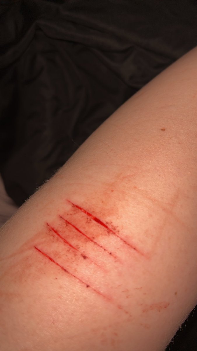 m0rgan143's tweet photo. FAKE BODY. SFX MAKEUP.!!!!

I ran out of room on my thighs. Fuck. https://t.co/39gQ6zF2xD