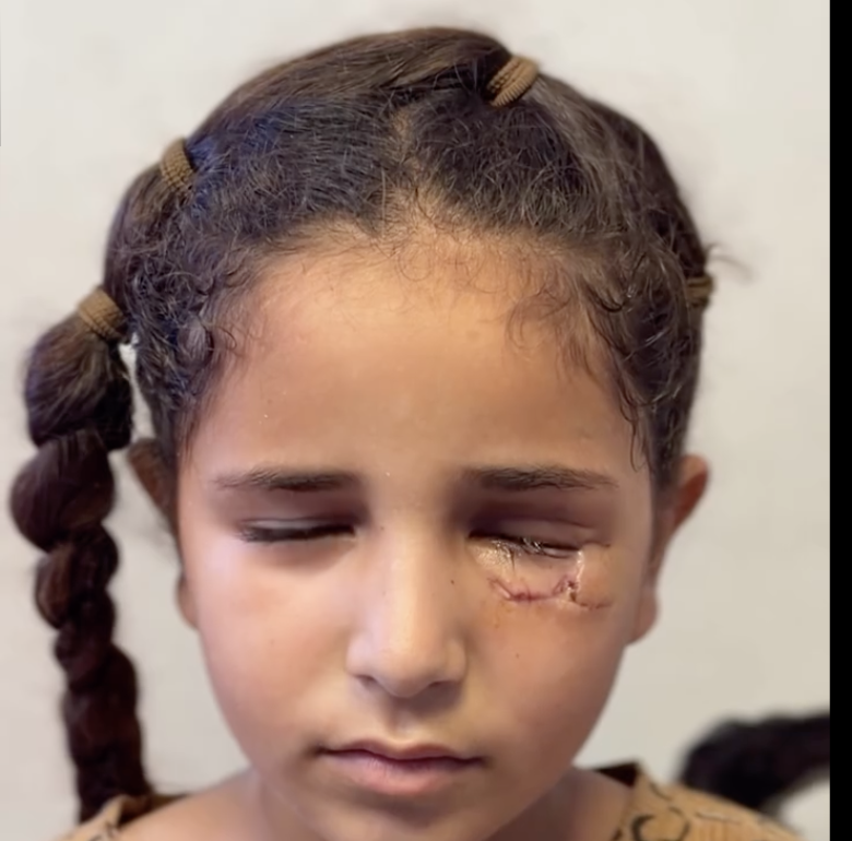 susanabulhawa's tweet photo. While polite society gives standing ovations for mass murderers anonymously confessing to their crimes, photographer @AmrTabash, and a thousand unsung heroes like him, continue to document the faces, bodies, and voices of the victims who survived their cruelty. https://t.co/OYRBcy04hp