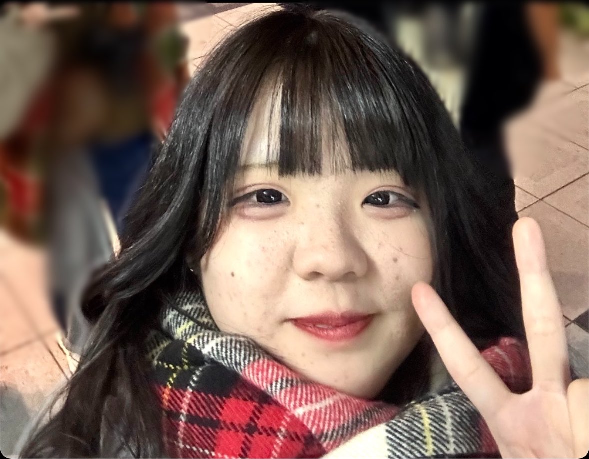 yunochi_01_n's tweet photo. 「元がいいから」って言われるけど、
もし本当に元がよかったなら、
中学の頃に「豚」とか「横綱」なんて呼ばれてないし、いじめられてもない。

言葉って、ひとつで自信にもなるし、逆に一生残る傷にもなる。

言った側にとっては何気ない一言でも、
言われた側にとっては、何年経っても消えない傷になります。

だから私は、あの頃の自分を変えたかっただけです。
(3、4枚目は整形前の20歳の頃です)