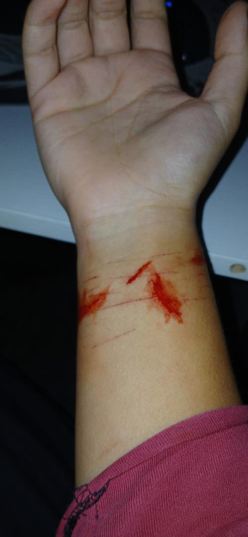 SatoshiRyui's tweet photo. Back when i was 11 i use to always make my makeup look like i was ripping my skin off, so cool🥰

Sfx fake makeup!
#shtwt #sh #cuts #sharm #vent https://t.co/vdF2YAOlM0