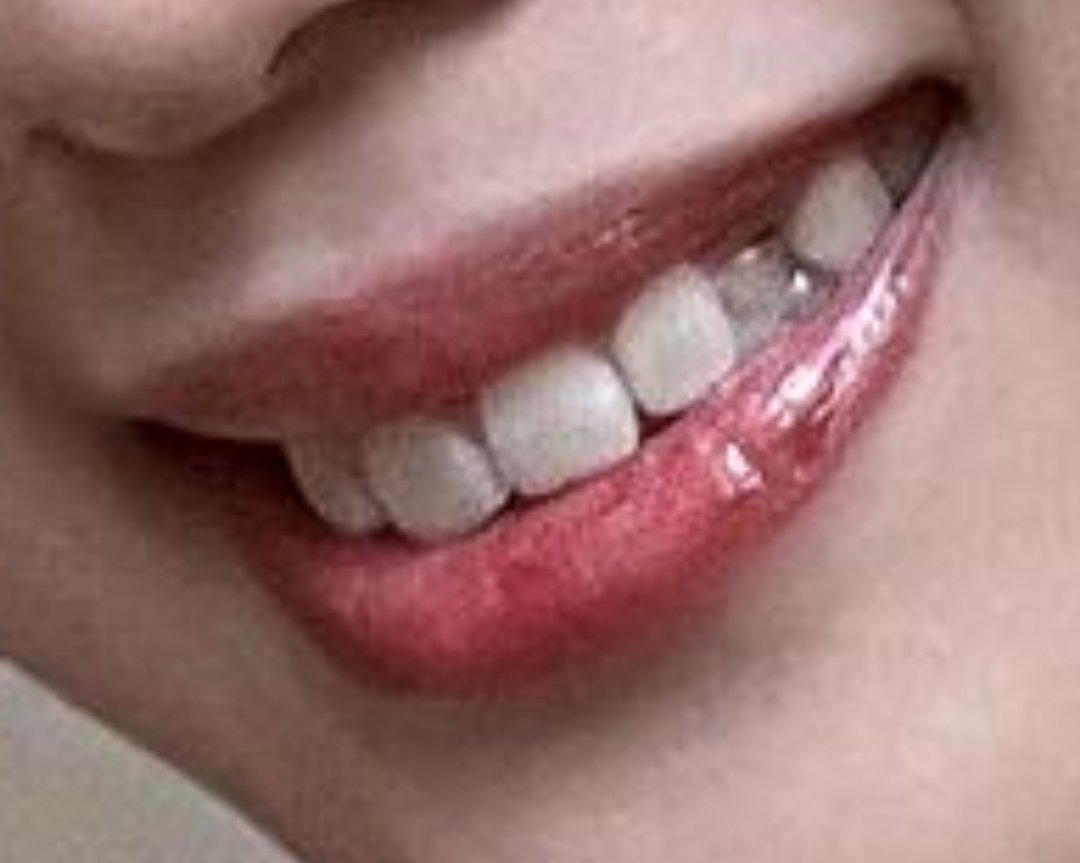 Mel_syrax's tweet photo. Vey? Deveria se preocupar menos com os estrangeiros e sim com essa falta de dente horrorosa https://t.co/D7uoGRPPb4