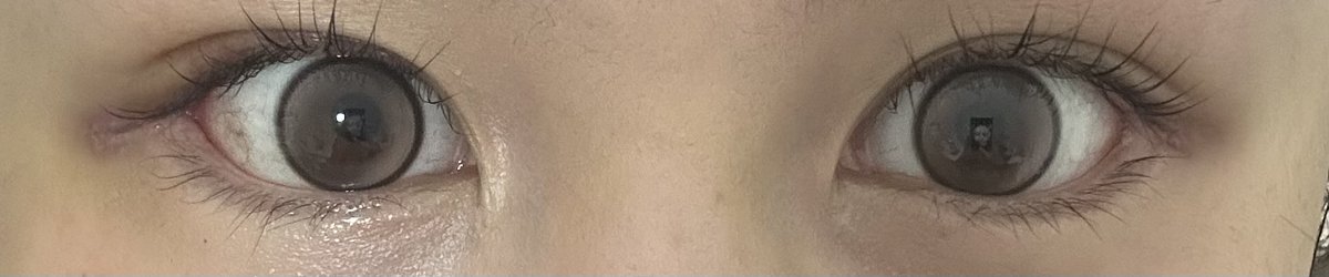 miii7757's tweet photo. 抜糸しました！カラコンありです！
右目は順調だけど、左目の傷の治りがすこし悪いみたい、、、😭😭まだ1週間目なのでもう少し経過観察してみます（；；）
目尻の形は鋭角になっててとっても綺麗👀
@swaypsjapan https://t.co/020ByMWFIn