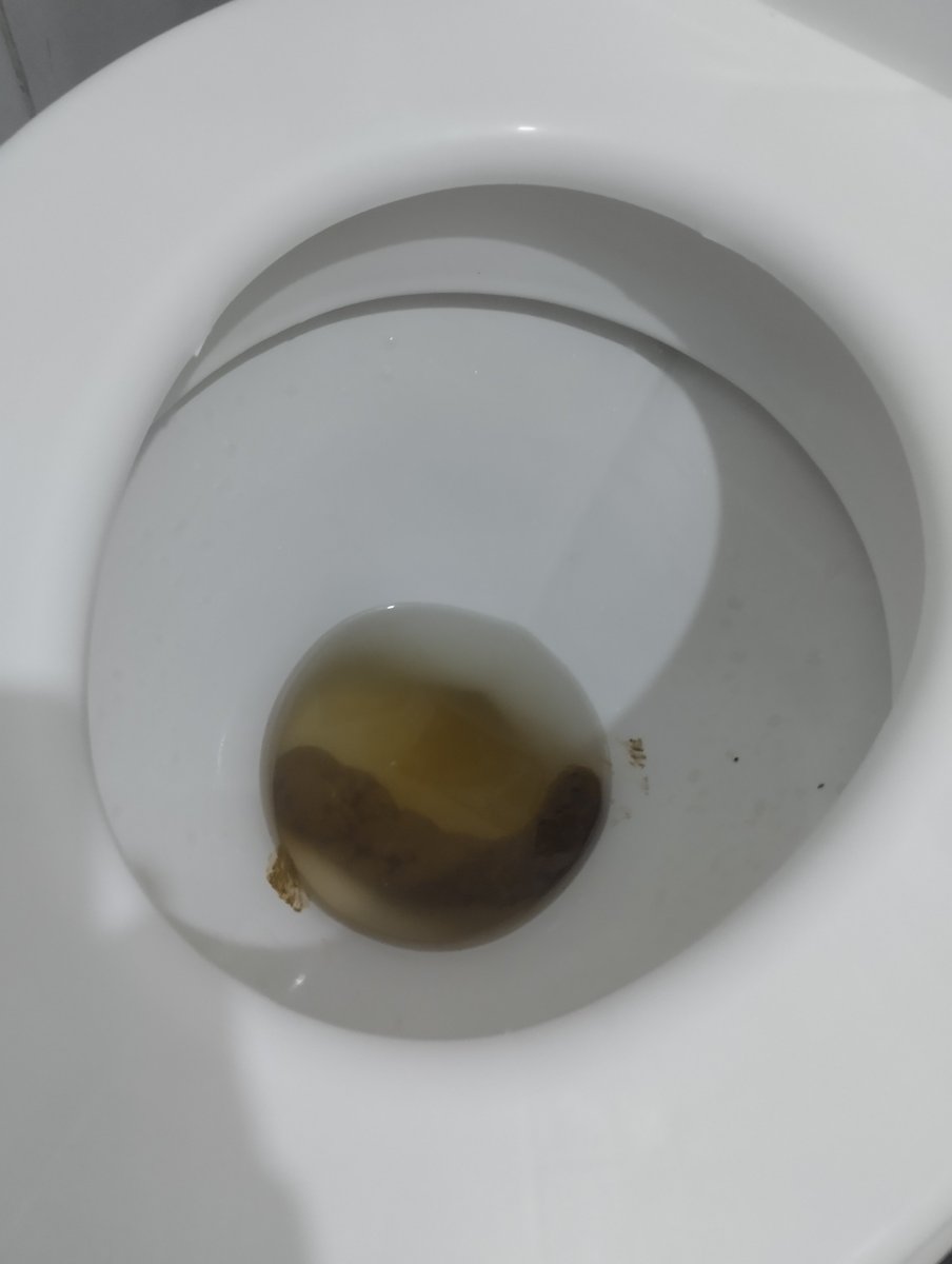 anonymous_25776's tweet photo. Holy shit (literally), that was a huge one! It slid out pretty easily though... https://t.co/gcfmzgFD1u