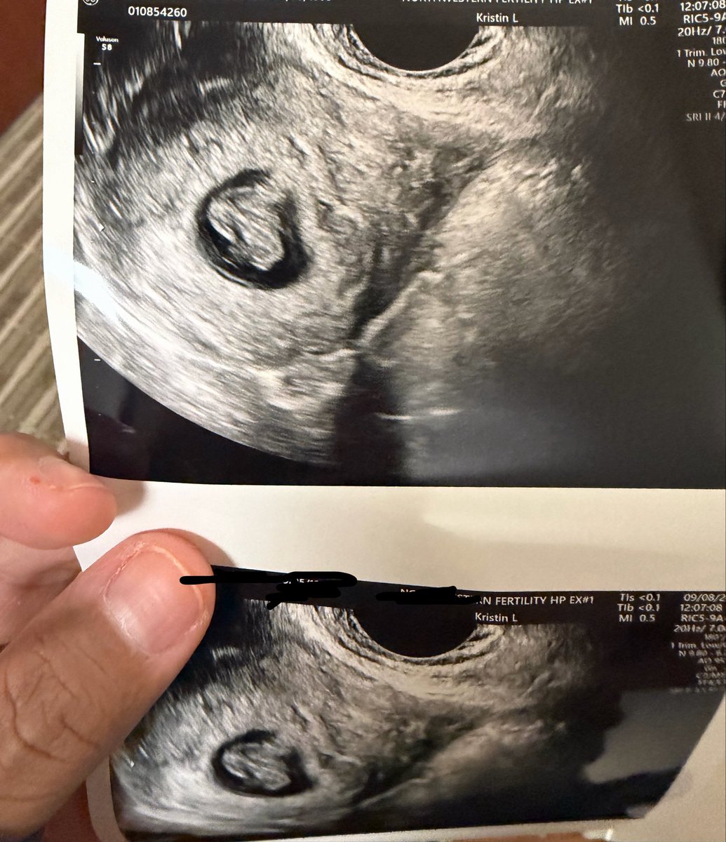 sapphicssay's tweet photo. MY DEAR FRIENDS AND JKRS: 
I HAVE. NEWS. 
I CAN OFFICIALLY SAY: 
WE ARE PREGNANT WITH BABY NO. 2!!!!
WE ARE GONNA BE MAMAS TO TWO KIDS!!!!

BABY JKR 💜✨ IS ON THE WAY 🚼🐣🍼

#LingOrm #หลิงออม https://t.co/RzUkTa8Urg
