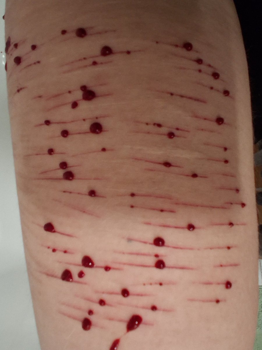 Sevenmustdiee's tweet photo. Wish i couldve gone deeper but oh well 😿😿😿 #shedrtwt https://t.co/wXNYmgXj9x