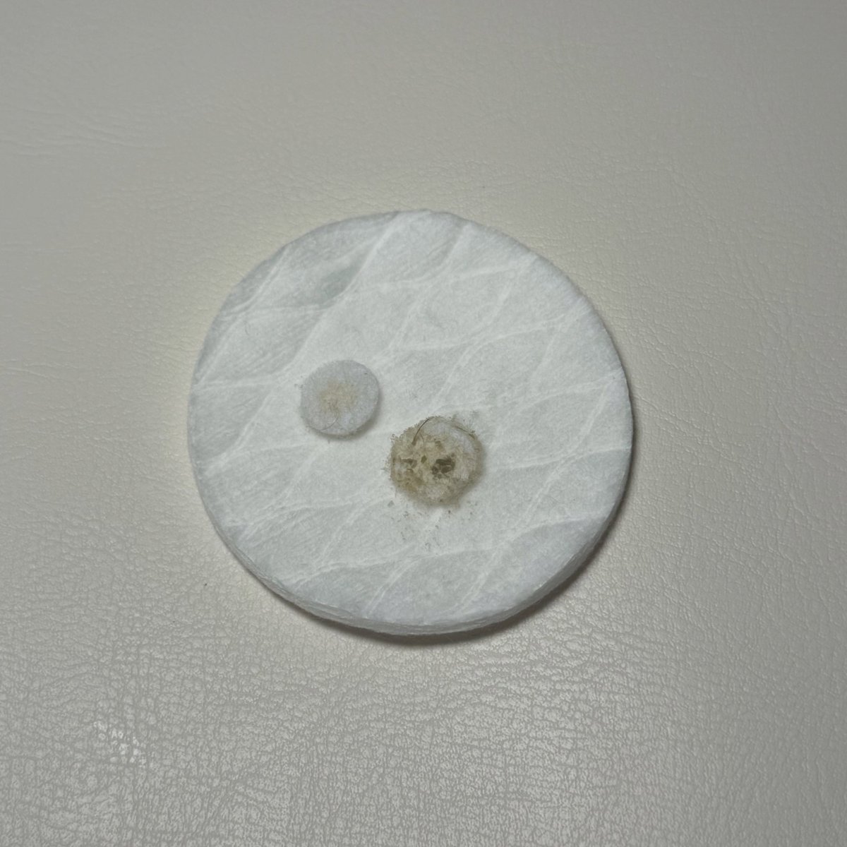 JacqueZolty's tweet photo. Swipe to see what can build up on your skin. Microdermabrasion removes dead skin cells, excess oil, and surface buildup, leaving skin smoother and helping skincare absorb better. The result: fresher, smoother, well-cared-for skin. DM for advice or https://t.co/8w8yDSKPJW